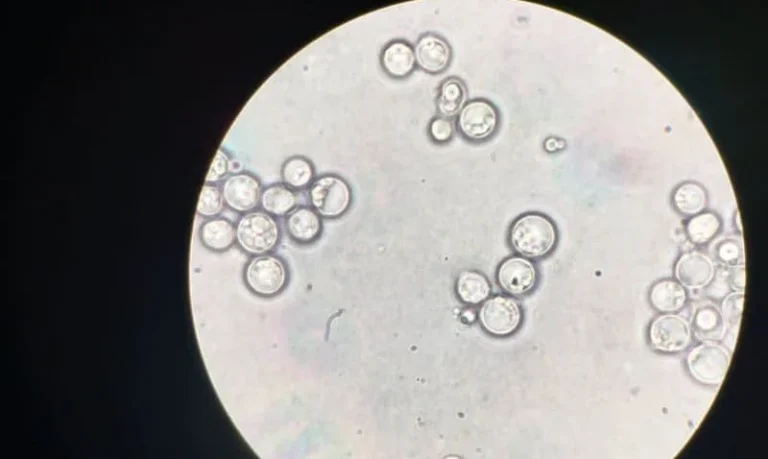 Torulaspora delbrueckii - De Geheimen van Fruitige en Bloemige Aroma's in Je Eigen Wijn